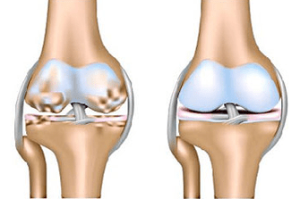 Healthy joint and joint