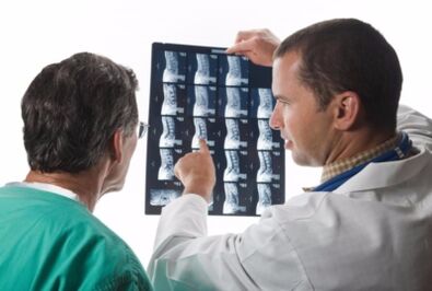 Doctor looks at spine pictures
