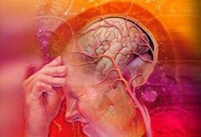 Migraine syndrome