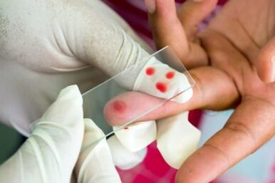 Diagnosis of pain in fingers joints