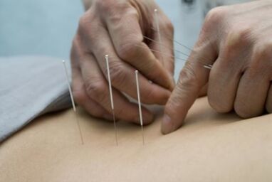 Acupuncture for osteochondrosis of the chest region